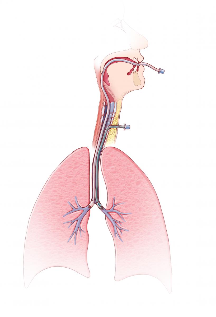 Multidisciplinary Management and Repair of a Traumatic Posterior